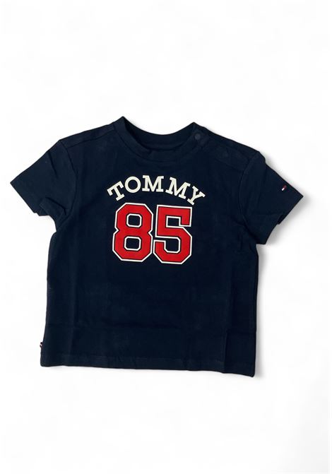  Tommy Hilfiger | KN0KN01758DW5